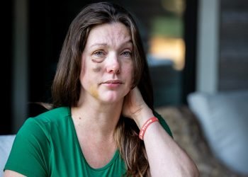 Cincinnati viral beating victim says violent mob started attacking ‘like a pack of wolves’