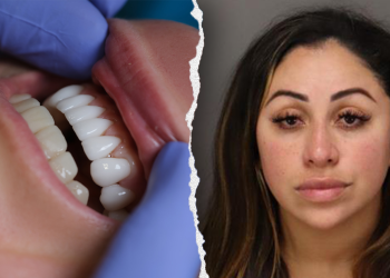 Florida woman arrested for unlicensed dental work allegedly used superglue on victims’ teeth: police